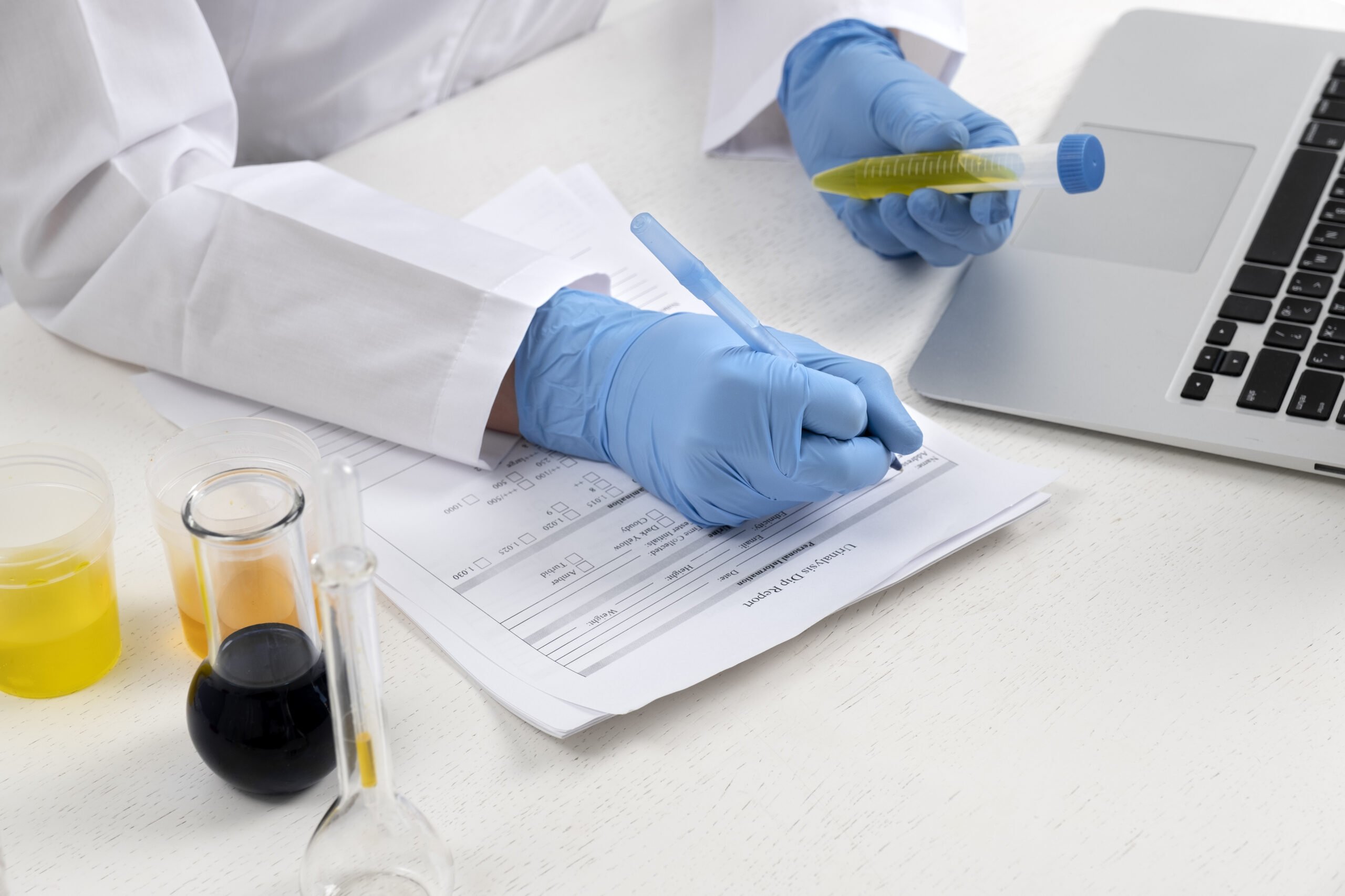 lab-doctor-performing-medical-exam-urine